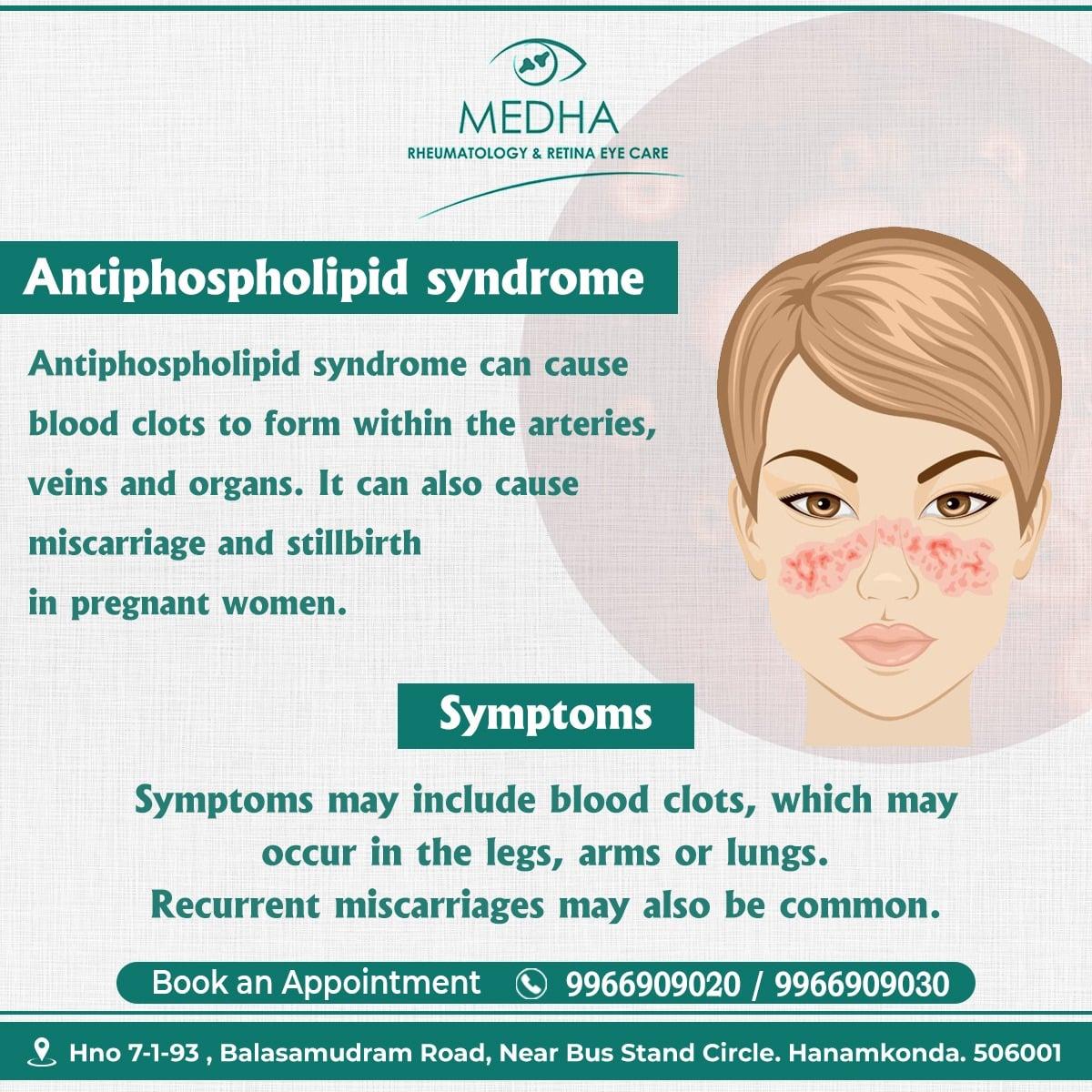 Antiphospholipid Syndrome Symptoms